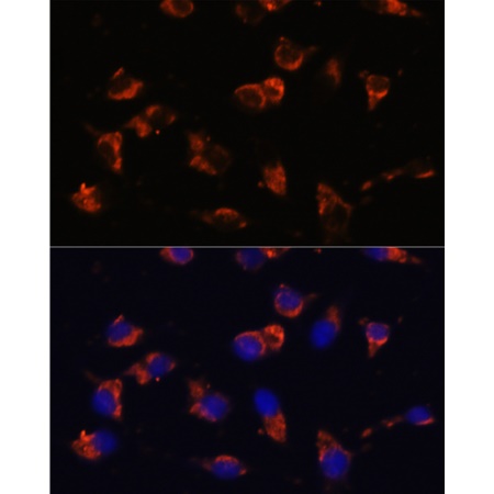 ABclonal CA19-9 Mouse mAb - 20 | A17437-20UL | ABCLONAL | SLS